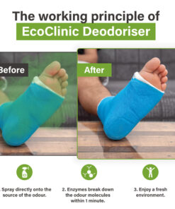 Voor-en-na-afbeelding van een voet in een blauw gipsverband, waarbij EcoClinic Ontgeurder wordt gebruikt om geur te verwijderen.