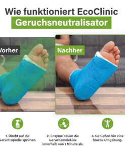 Voor-en-na-afbeelding van een voet in een blauw gipsverband, waarbij EcoClinic Ontgeurder wordt gebruikt om geur te verwijderen.